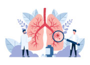 ASCO 2026: Ivonescimab verbessert Überleben beim squamösen NSCLC
