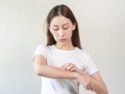 Einfluss der Atopischen Dermatitis auf Ausbildung und Berufswahl
