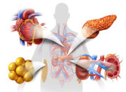 Erste Leitlinie zum kardiorenal-metabolischen Syndrom setzt auf Früherkennung und interdisziplinäre Versorgung
