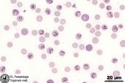 Zeckenstich mit großen Folgen für Hunde: Babesia canis breitet sich in Deutschland aus