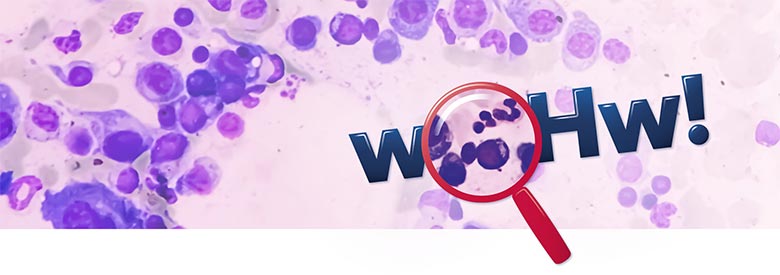 wOHw – Der Wissenskanal Onko- und Hämatologie