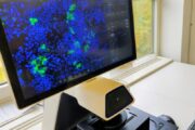 Warum das Hepatitis-E-Virus keine Mäuse infizieren kann
