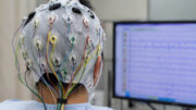Parkinson: Neue EEG-Signatur könnte Therapien präziser steuern