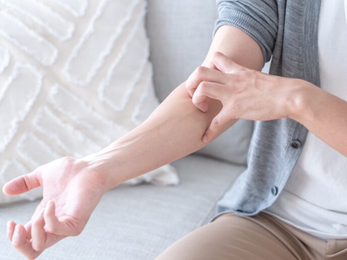 atopische Dermatitis