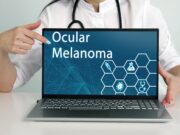 Neues Modell für Melanome mit BAP1-Verlust entwickelt