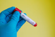 Hepatitis-E-Viren verändern sich schon früh während der Infektion