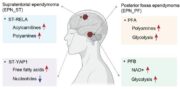 Ependymome: Metabolomische Analyse identifiziert neue Therapieziele