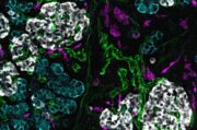 Entwicklung des kindlichen Pankreas könnte aufdecken, wie Diabetes entsteht