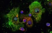 Asthma: Neuer Wirkmechanismus bremst Entzündungsreaktion