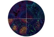 Spatialproteomics: Neue Software erleichtert die Analyse komplexer Gewebebilder