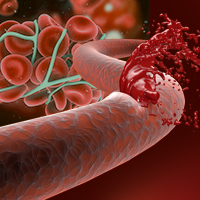Vena arteria rottura taglio emorragia sangue