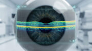 STOC-T kann hochauflösende Bildgebung von Retina und Choroidea verbessern