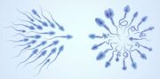 Expertengruppe empfiehlt, die Beurteilung der Spermienmorphologie stark zu vereinfachen