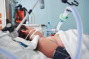 Beatmung auf Intensivstation: Patientenwünsche und tatsächliche Versorgung stimmen oft nicht überein