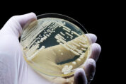 Synthetisches Zuckermolekül bietet neuen Ansatz gegen Candida auris