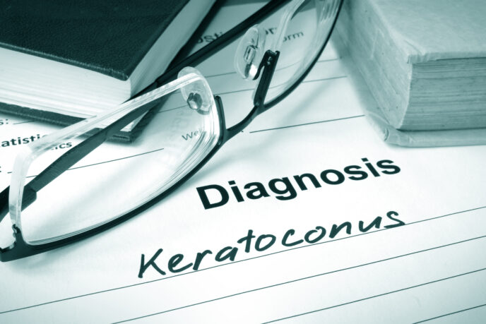 Eine Brille liegt auf einem Blatt Papier, auf dem Diagnose Keratokonus steht.