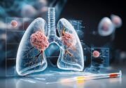 Neuer Therapieansatz bei NSCLC: Therapeutikum bekämpft auch Medikamentenresistenz